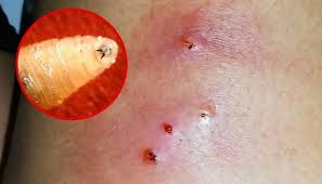 خطورة الدودة الحلزونية اكله اللحوم الحيه بعد اعلان أمريكا ظهور اول حاله مرضيه